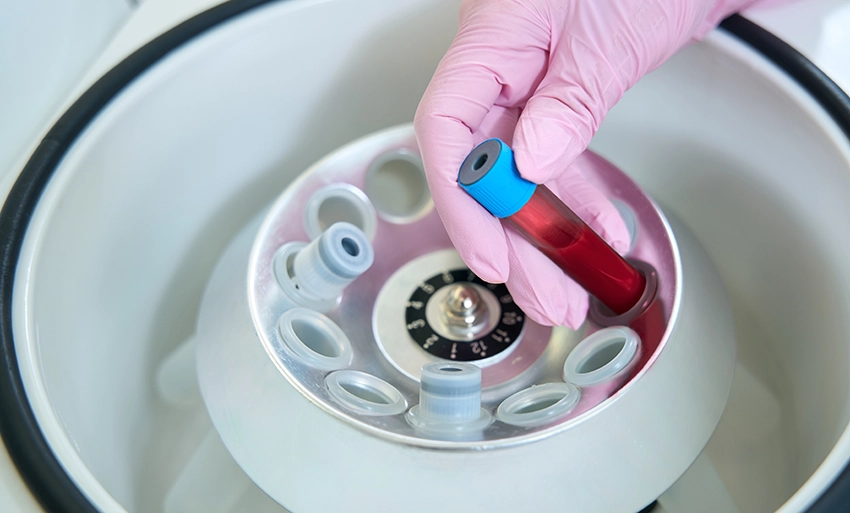 Neogen® Molecular Detection Instrument